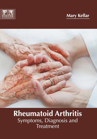 Rheumatoid Arthritis