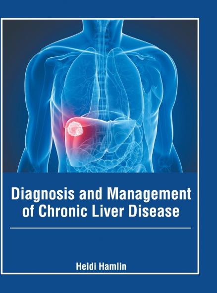 Diagnosis and Management of Chronic Liver Disease