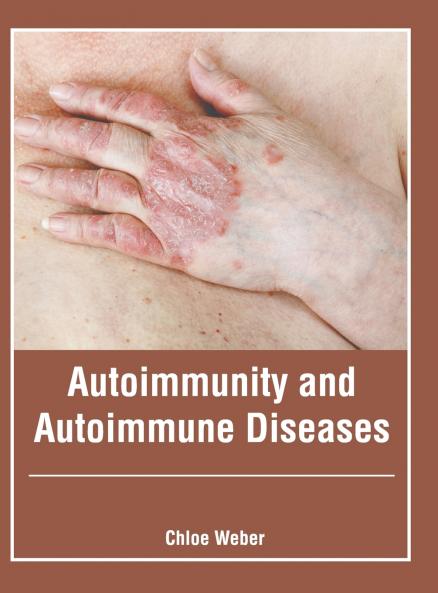 Autoimmunity and Autoimmune Diseases