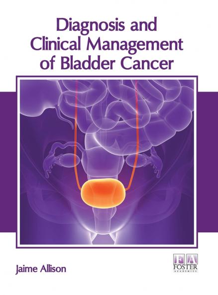 Diagnosis and Clinical Management of Bladder Cancer