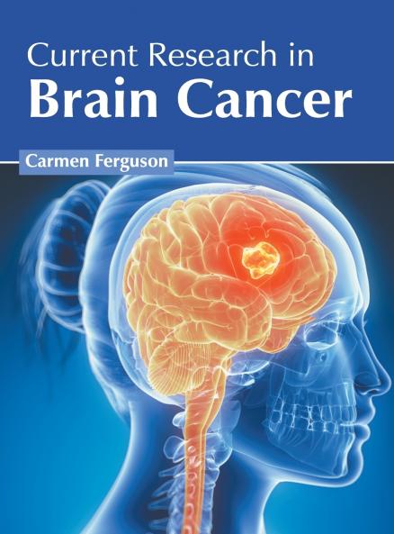 Current Research in Brain Cancer