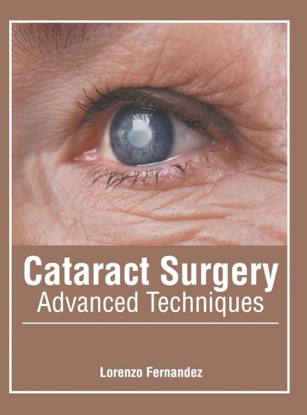 Cataract Surgery
