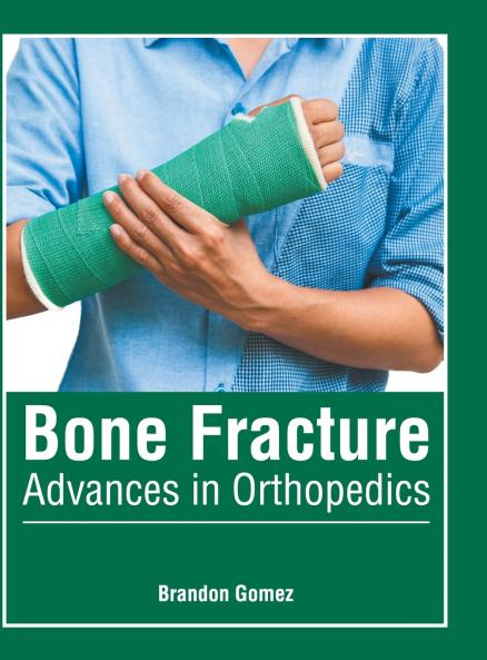 Bone Fracture