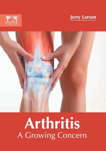 Arthritis