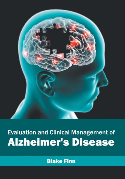 Evaluation and Clinical Management of Alzheimer's Disease