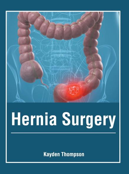 Hernia Surgery