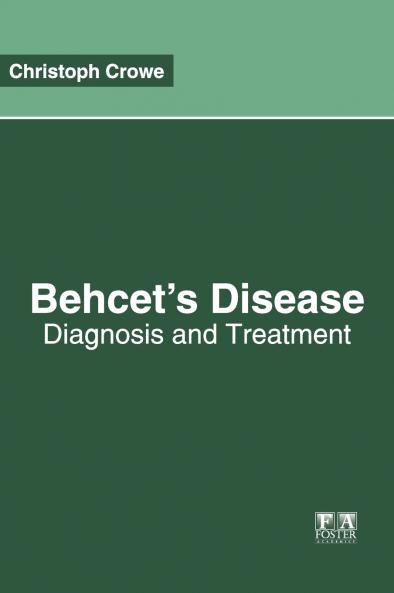 Behcet's Disease