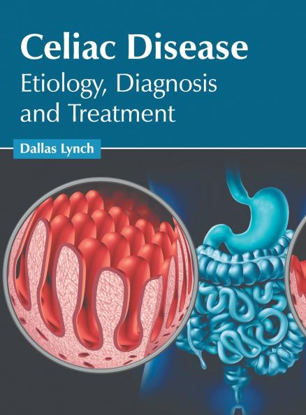 Celiac Disease