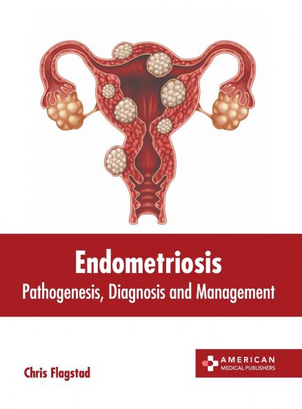 Endometriosis