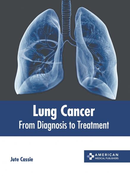 Lung Cancer
