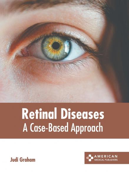Retinal Diseases