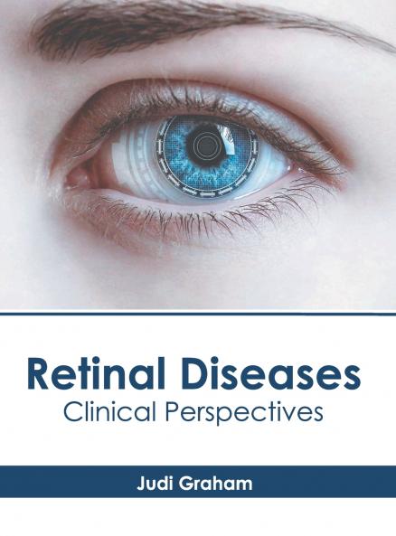 Retinal Diseases