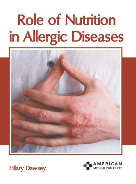 Role of Nutrition in Allergic Diseases