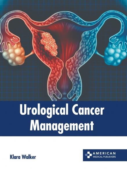 Urological Cancer Management