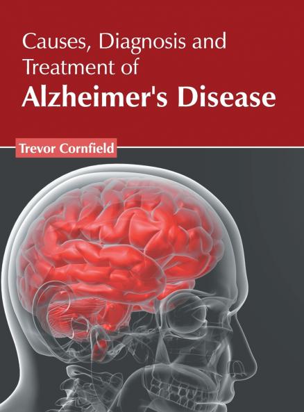 Causes Diagnosis and Treatment of Alzheimer's Disease