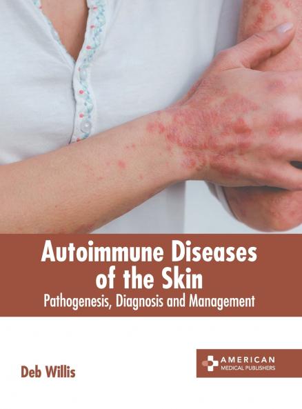 Autoimmune Diseases of the Skin