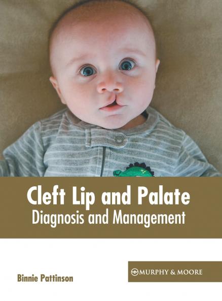 Cleft Lip and Palate