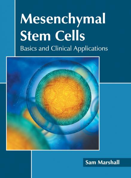 Mesenchymal Stem Cells