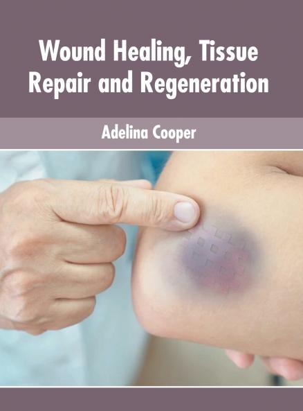 Wound Healing Tissue Repair and Regeneration