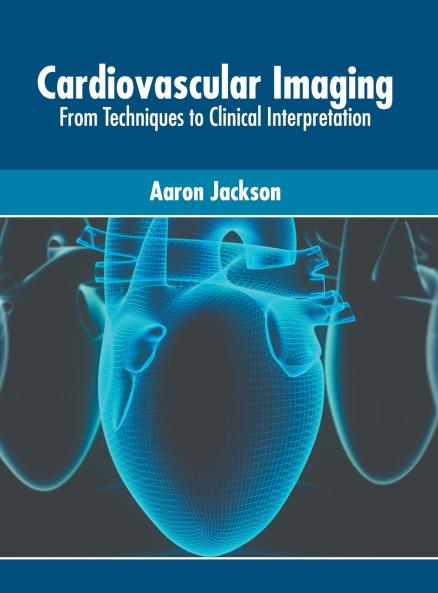 Cardiovascular Imaging