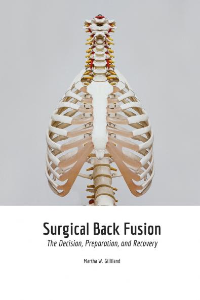 Surgical Back Fusion