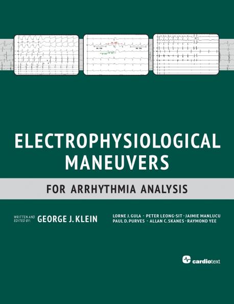 Electrophysiological Maneuvers for Arrhythmia Analysis
