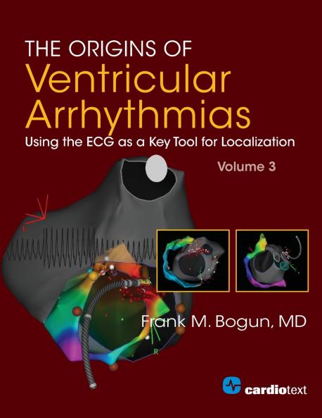 The Origins of Ventricular Arrhythmias