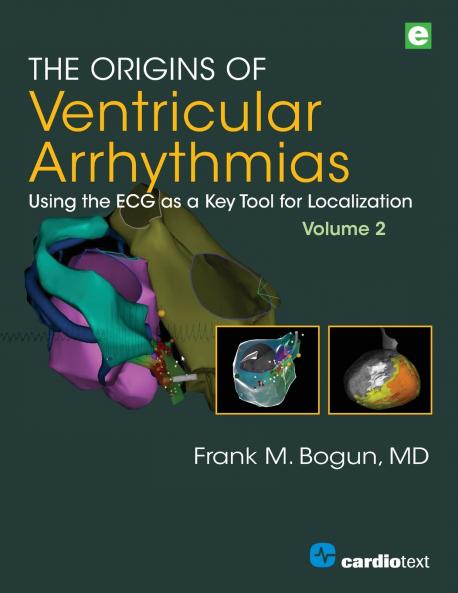 The Origins of Ventricular Arrhythmias Volume 2