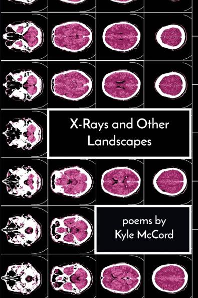 X-Rays and Other Landscapes