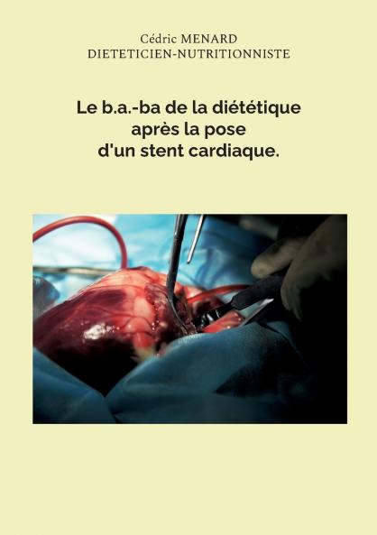 Le b.a.-ba de la diététique après la pose d'un stent cardiaque.