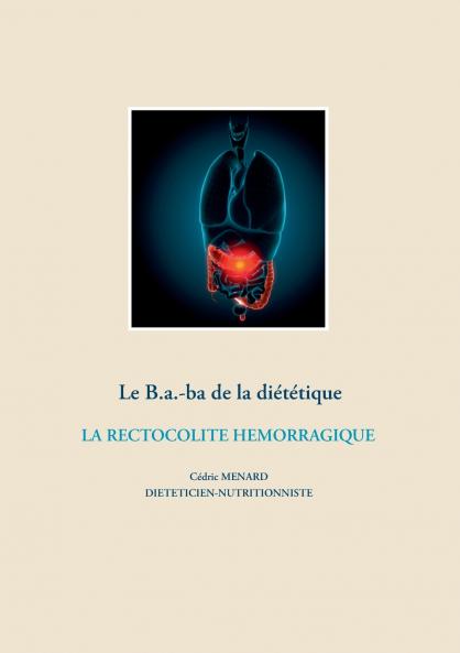 Le B.a.-ba de la diététique de la rectocolite hémorragique