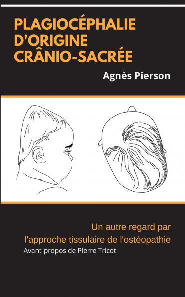plagiocéphalie d'origine crânio-sacrée