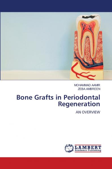 Bone Grafts in Periodontal Regeneration