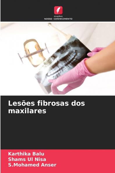 Lesões fibrosas dos maxilares