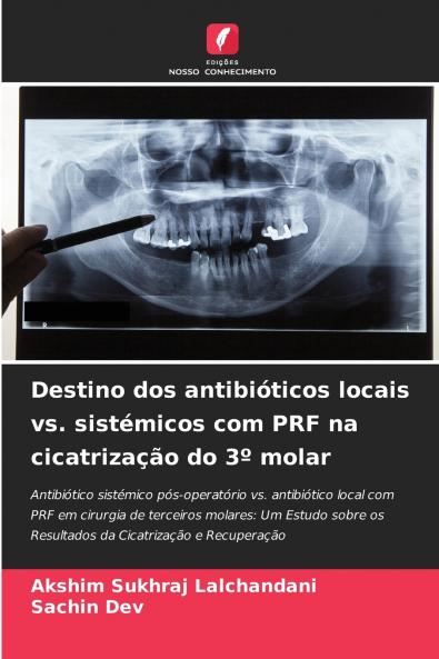 Destino dos antibióticos locais vs. sistémicos com PRF na cicatrização do 3º molar