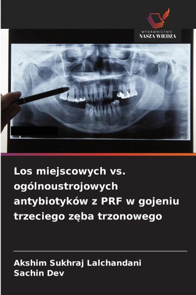 Los miejscowych vs. ogólnoustrojowych antybiotyków z PRF w gojeniu trzeciego zęba trzonowego