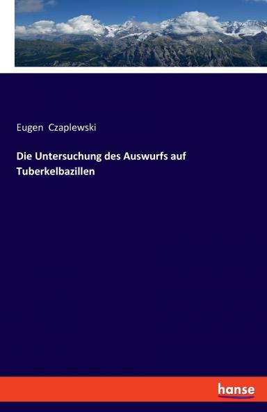 Die Untersuchung des Auswurfs auf Tuberkelbazillen