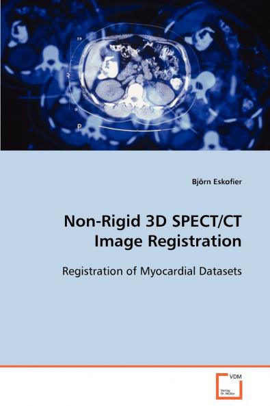 Non-Rigid 3D SPECT/CT Image Registration
