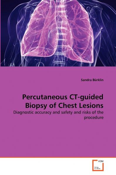 Percutaneous CT-guided Biopsy of Chest Lesions