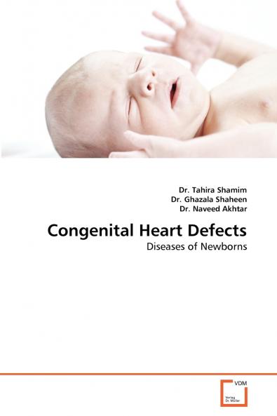 Congenital Heart Defects