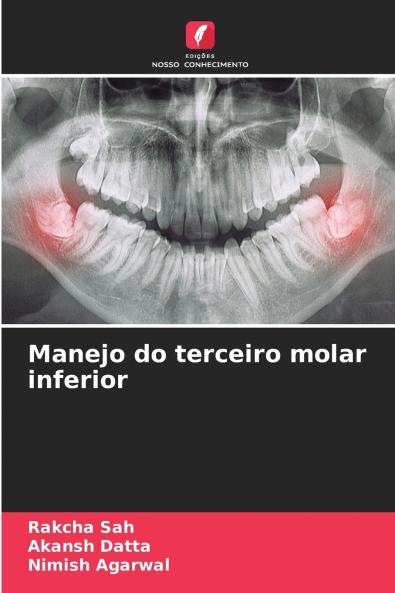 Manejo do terceiro molar inferior
