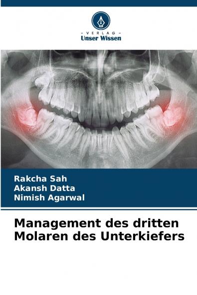Management des dritten Molaren des Unterkiefers