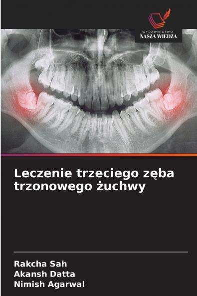 Leczenie trzeciego zęba trzonowego żuchwy