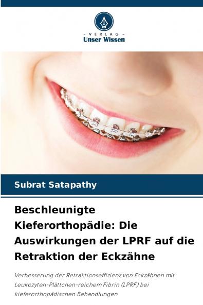 Beschleunigte Kieferorthopädie
