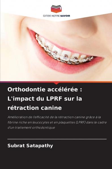Orthodontie accélérée