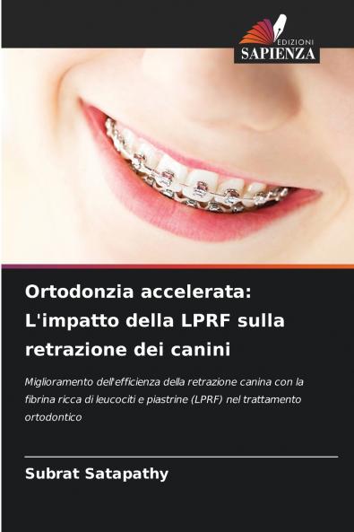 Ortodonzia accelerata