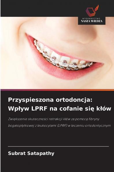 Przyspieszona ortodoncja