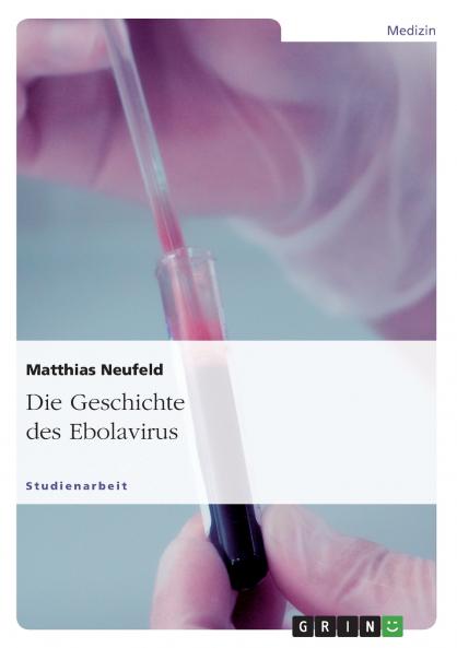 Die Geschichte des Ebolavirus