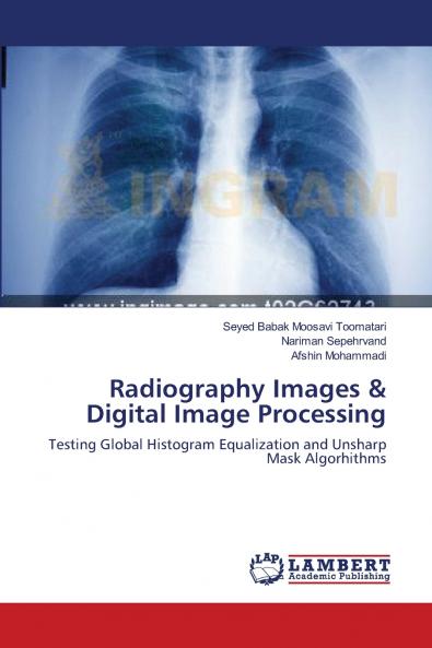 Radiography Images & Digital Image Processing