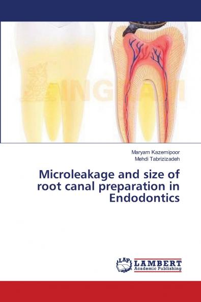 Microleakage and size of root canal preparation in Endodontics